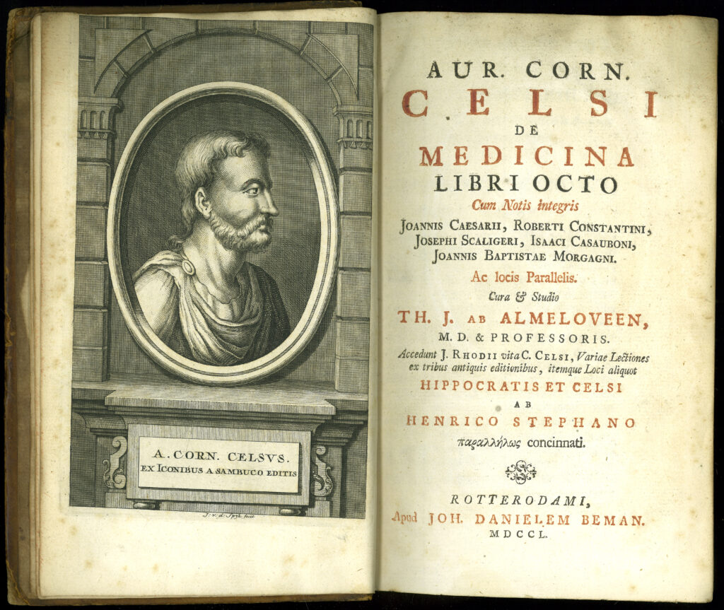 Aulus Cornelius Celsus: De Medicina